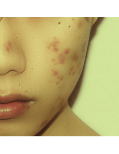 Pack pelle grassa e impura